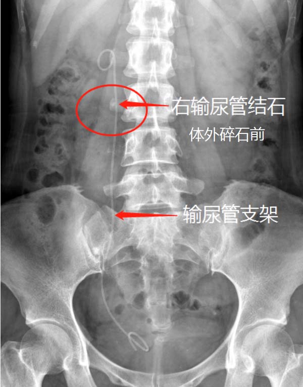 微信图片_20230207173326.jpg