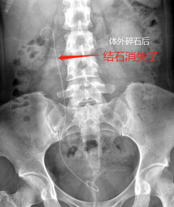 微信图片_20230207173328.jpg